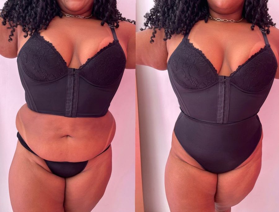 Cliente de frente antes e depois de vestir a calcinha modeladora