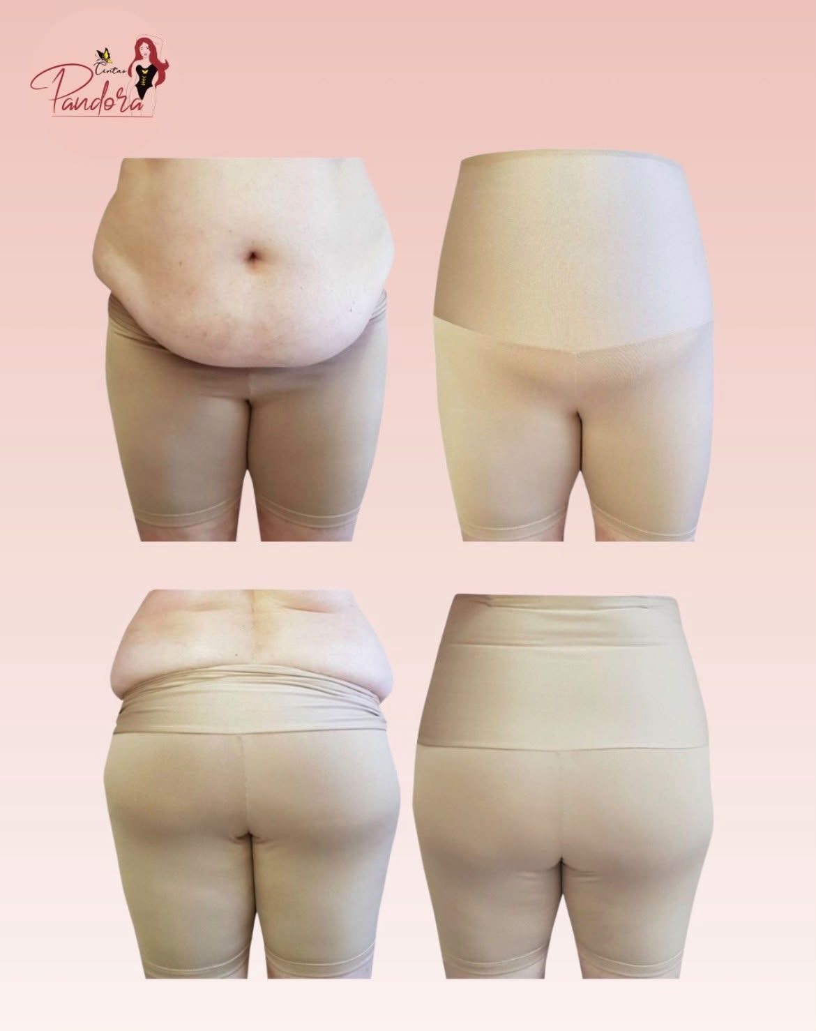 Barriga e costas de uma cliente sem a bermuda modeladora e depois vestindo a bermuda